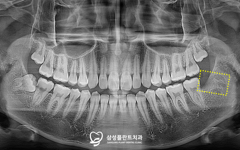 신정동치과